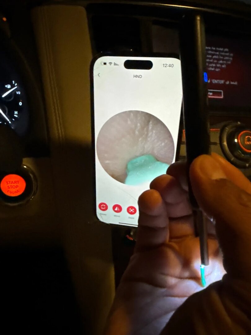 TESTRESULTAT 2025
Livore Utvecklad tillsammans med experter – för en trygg, modern och effektiv öronrengöring. Ger dig inte bara renare öron, utan också en klarare och starkare hörselupplevelse. Upptäck skillnaden redan idag!